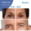 masque yeux chaud froid avant après