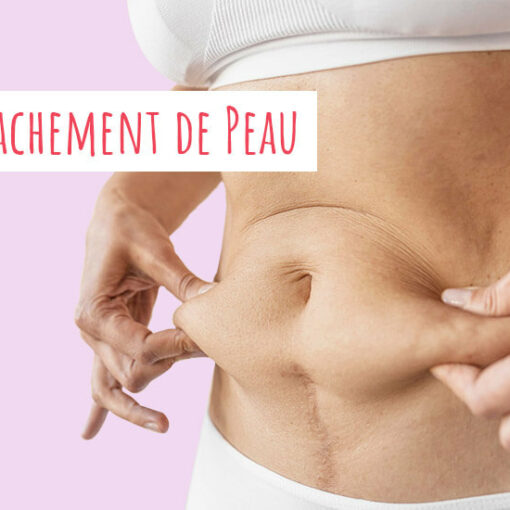 Comment éviter le relâchement de la peau