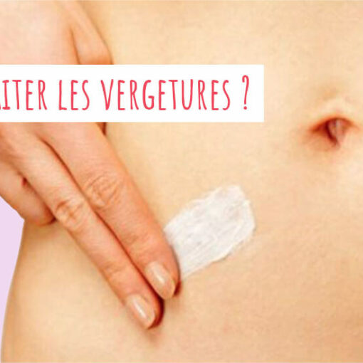 Vergetures: comment elles apparaissent, comment elles s'atténuent ?