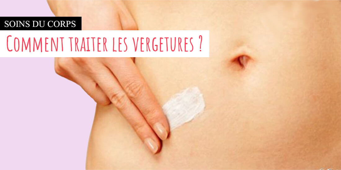 Vergetures causes et effets