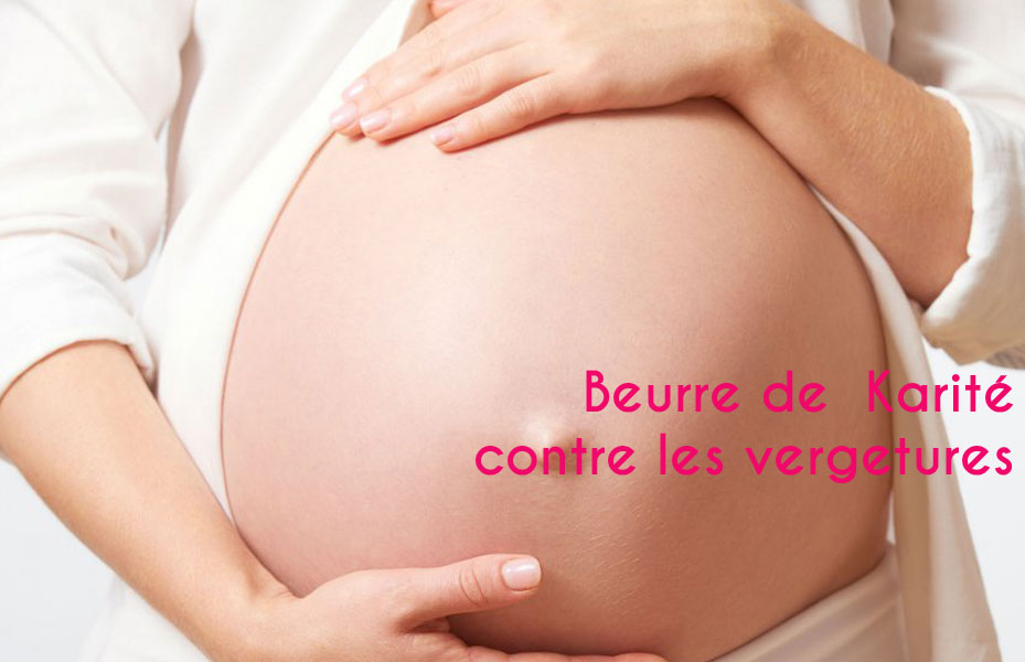 karité vergetures karité vergetures