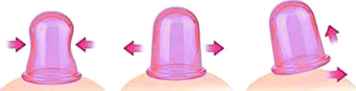 fonctionnement de la ventouse anticellulite