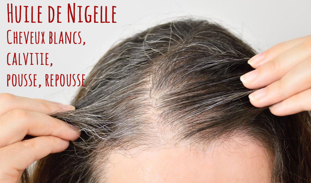 Huile de Nigelle Cheveux : Tout savoir sur ses bienfaits pour notre cuir chevelu et nos cheveux
