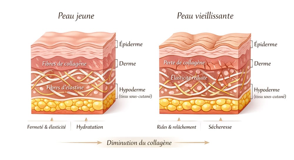 coupe transversale de peau jeune et peau vieillissante montrant la perte de collagène